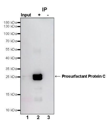 Prosurfactant Protein C Recombinant Rabbit mAb (S-1773-6)