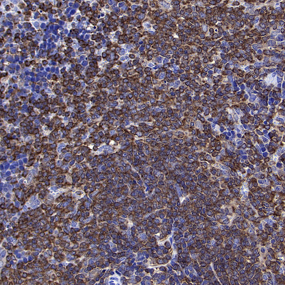 PTPN6 Rabbit Polyclonal Antibody