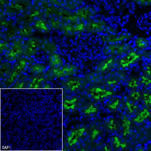 CD10 Recombinant Rabbit mAb (Alexa Fluor® 488 Conjugate) (S-006-77)
