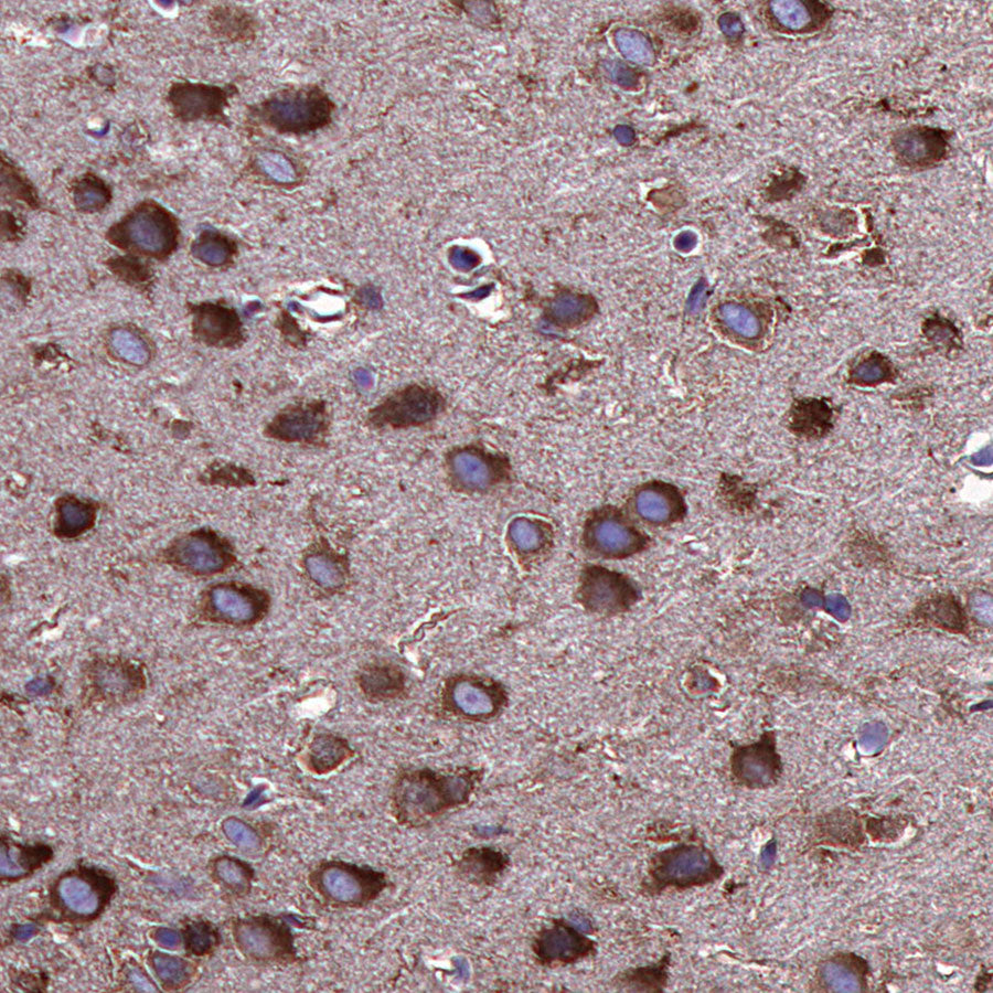 HSP90 alpha/beta Recombinant Mouse mAb (S-5282)