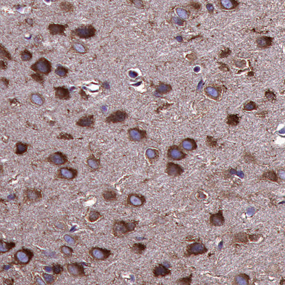 HSP90 alpha/beta Recombinant Mouse mAb (S-5282)