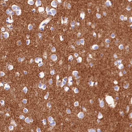 α/β-Synuclein Recombinant Rabbit mAb (S-309-72)