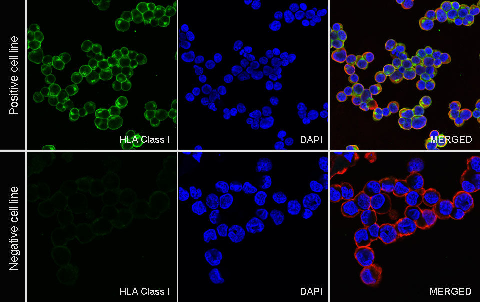 HLA Class I-A Recombinant Mouse mAb (S-3834)