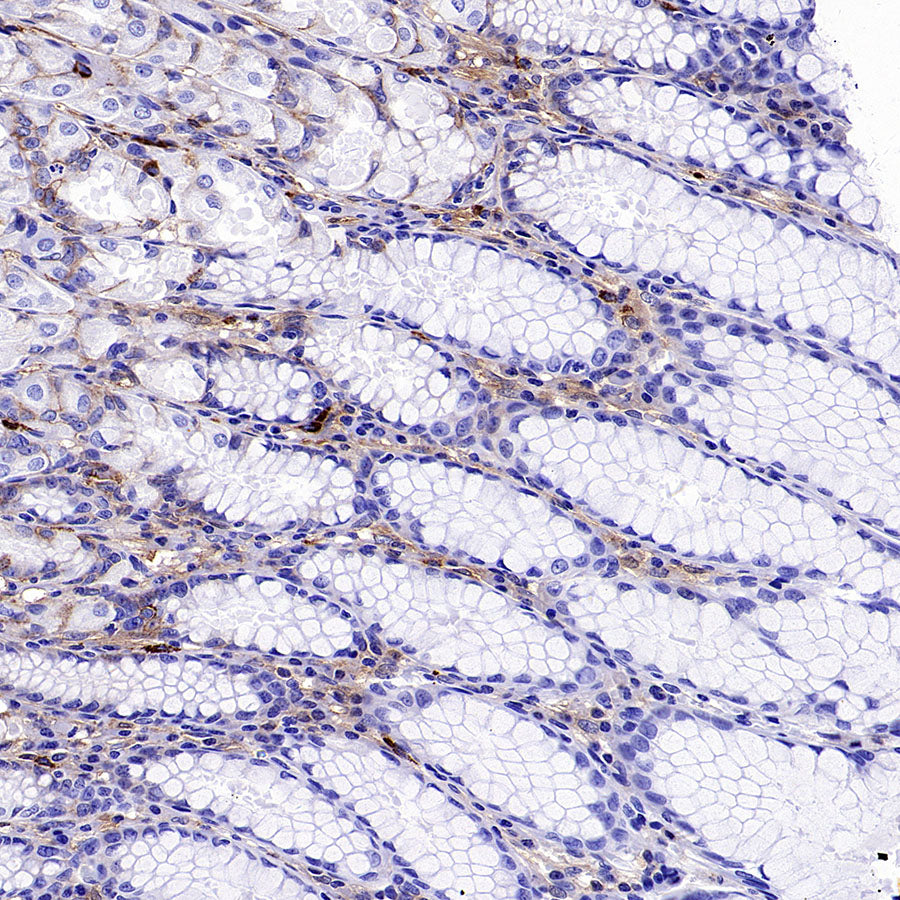 PTK7 Recombinant Rabbit mAb (SDT-2432-136)