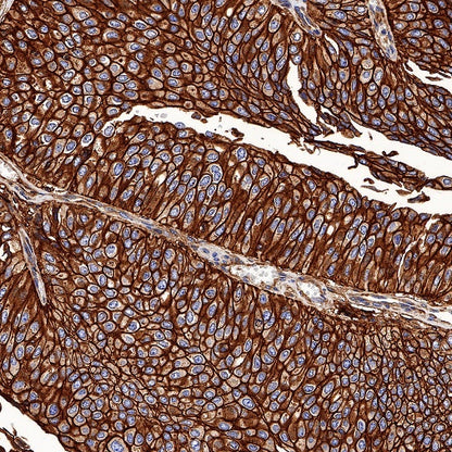HLA-E Recombinant Rabbit mAb (S-1081-62)