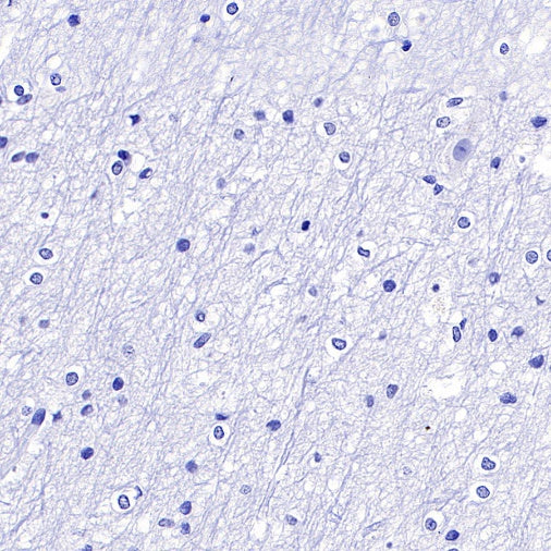 PHOX2B Recombinant Rabbit mAb (SDT-1142-21)