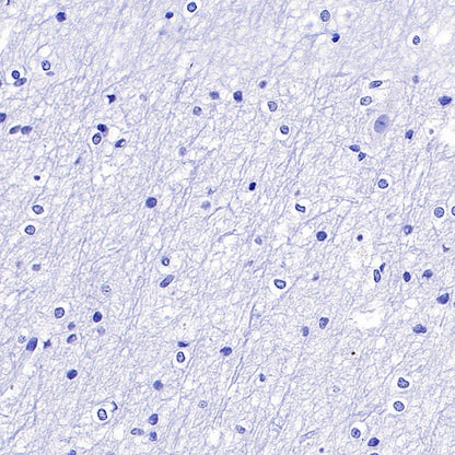 PHOX2B Recombinant Rabbit mAb (SDT-1142-21)