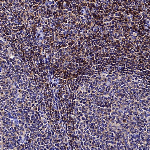 PIK3CD Recombinant Rabbit mAb (SDT-1978-148)