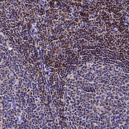 PIK3CD Recombinant Rabbit mAb (SDT-1978-148)