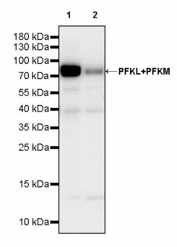PFKL+PFKM Recombinant Rabbit mAb (S-1302-31)