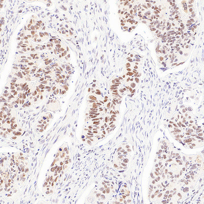 RAD21 Recombinant Rabbit mAb (S-4271-136)