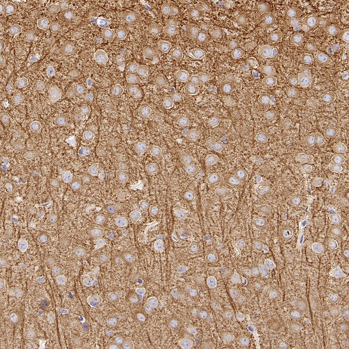 MAP2 Recombinant Rabbit mAb, PBS Only (SDT-2060-28)