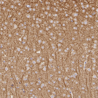 MAP2 Recombinant Rabbit mAb, PBS Only (SDT-2060-28)