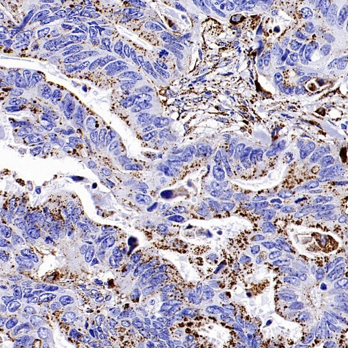 SCARB2/LIMPII Recombinant Rabbit mAb (S-2847-21)