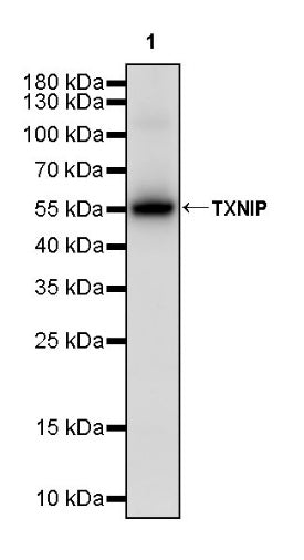 TXNIP Recombinant Rabbit mAb (S-2476-80)