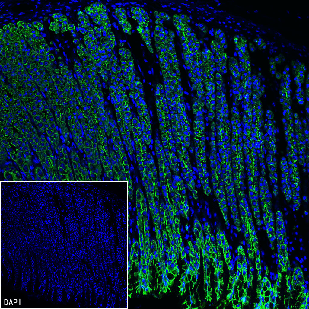 Cytokeratin 7 Recombinant Rabbit mAb (S-5954)