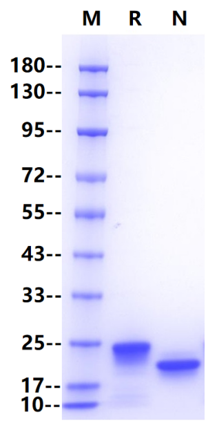 RBP4 His Tag Protein, Human
