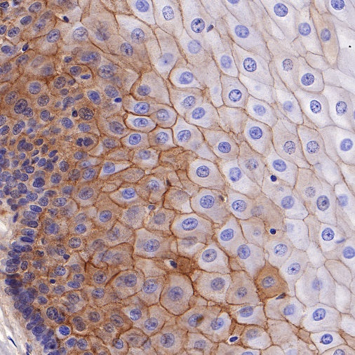 Nectin-1/PVRL1 Recombinant Rabbit mAb (S-279-140)