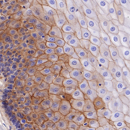 Nectin-1/PVRL1 Recombinant Rabbit mAb (S-279-140)