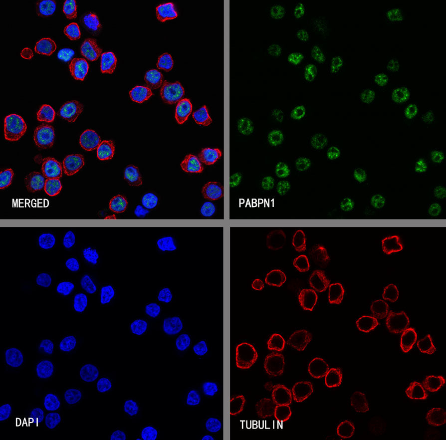 PABPN1 Rabbit Polyclonal Antibody