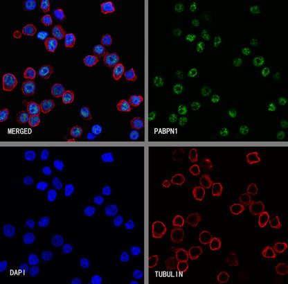 PABPN1 Rabbit Polyclonal Antibody