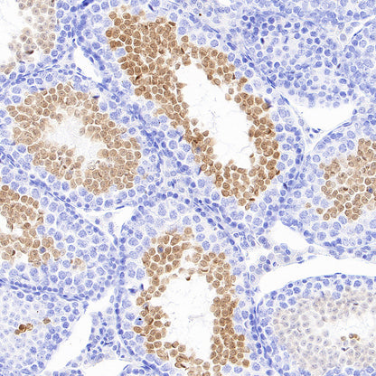 Stat4 Recombinant Rabbit mAb (S-4916-70)