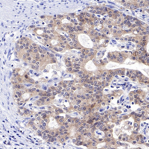 p90RSK Rabbit polyclonal antibody