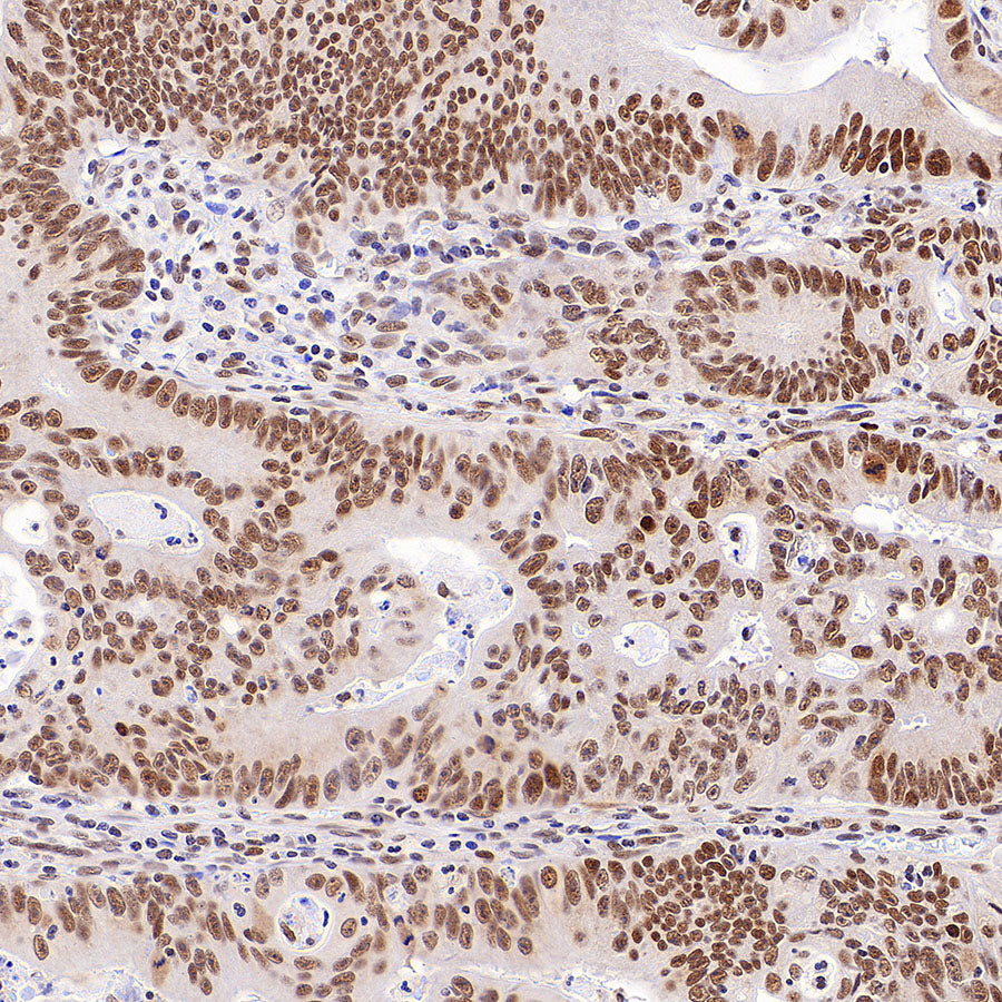 Phospho-STAT1 (Ser727) Recombinant Rabbit mAb