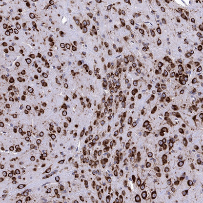 YTHDF2 Recombinant Rabbit mAb (S-1569-42)