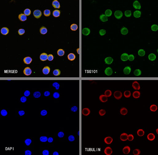 TSG101 Recombinant Rabbit mAb (S-1868-76)