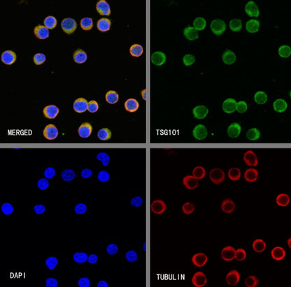 TSG101 Recombinant Rabbit mAb (S-1868-76)