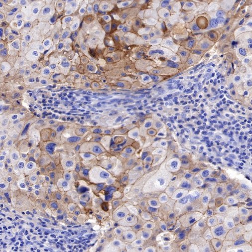 Nectin-4 Recombinant Rabbit mAb (SDT-277-314-1)