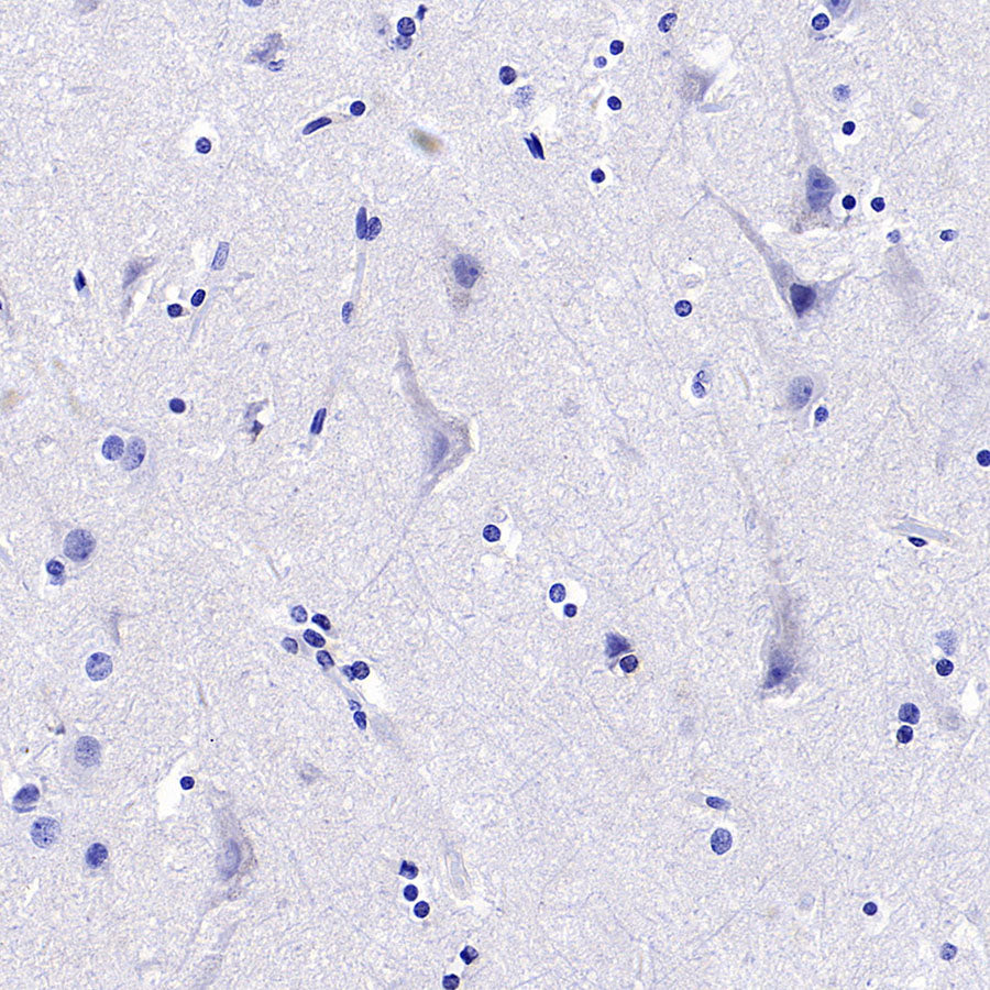 ARR3 Recombinant Rabbit mAb (S-3290-27)
