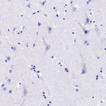 ARR3 Recombinant Rabbit mAb (S-3290-27)