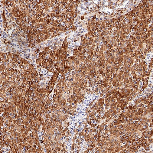 Sec61B Recombinant Rabbit mAb (S-4499-3)