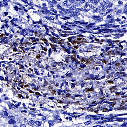 FGF Receptor 1 Recombinant Rabbit mAb (S-5668)