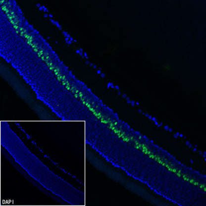 CHX10 Recombinant Rabbit mAb (S-3940-13)