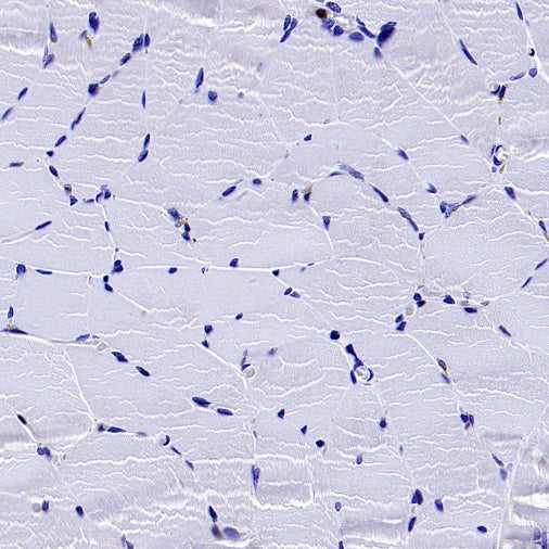 TKT Rabbit Polyclonal Antibody