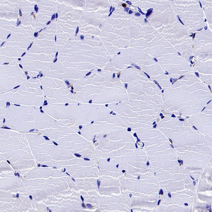 TKT Rabbit Polyclonal Antibody