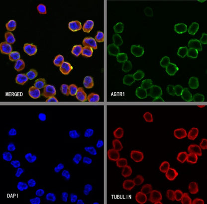 AGTR1 Recombinant Rabbit mAb (S-2447-22)