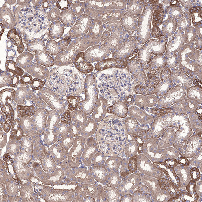 AMPKα Recombinant Rabbit mAb (S-455-38)