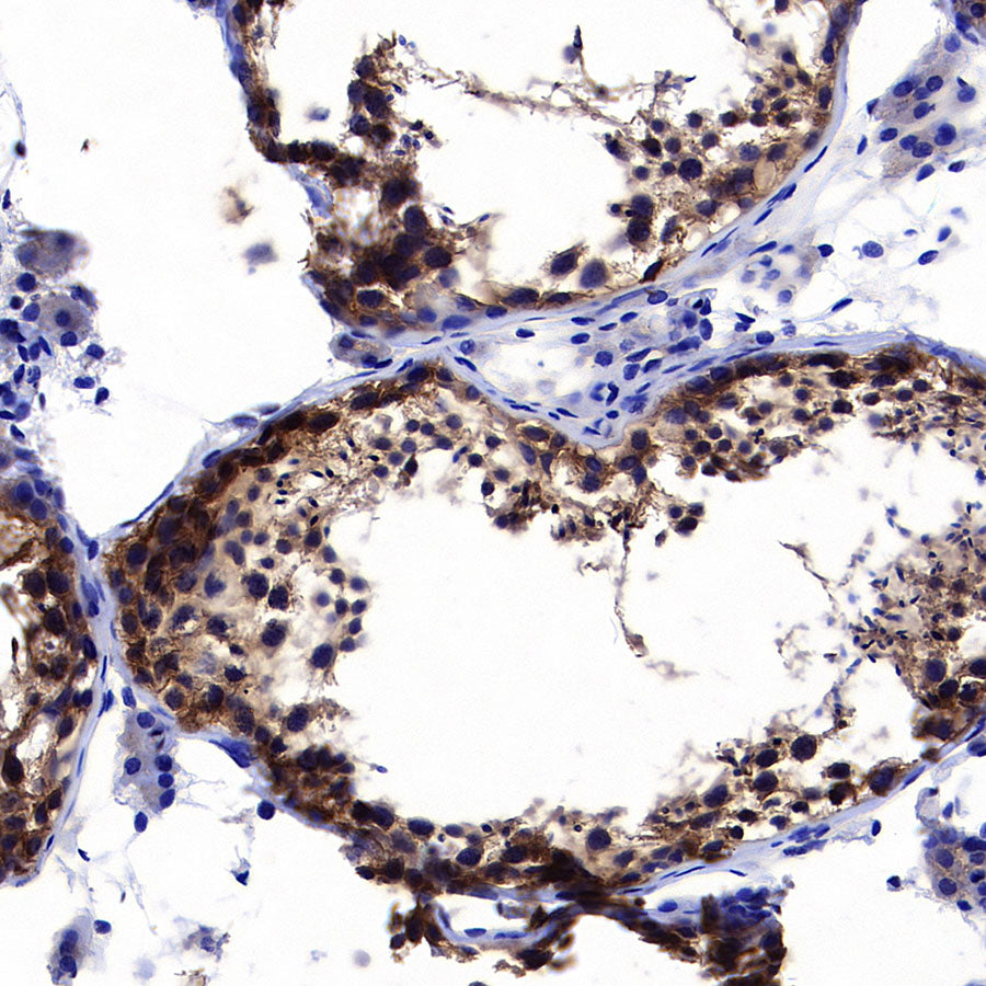 BCAR1 Recombinant Rabbit mAb (S-3542-49)