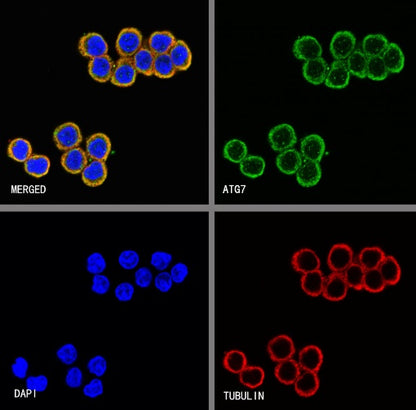 ATG7 Recombinant Rabbit mAb (S-1279-201)