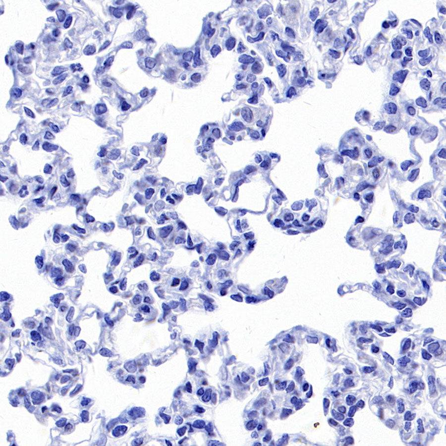 Hepatocyte Specific Antigen Recombinant Mouse mAb (SDT-4389)