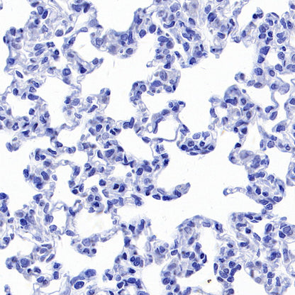 Hepatocyte Specific Antigen Recombinant Mouse mAb (SDT-4389)