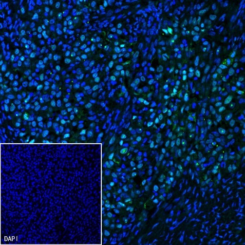 Wilms Tumor Protein (WT1) Recombinant Rabbit mAb (SDT-2864)