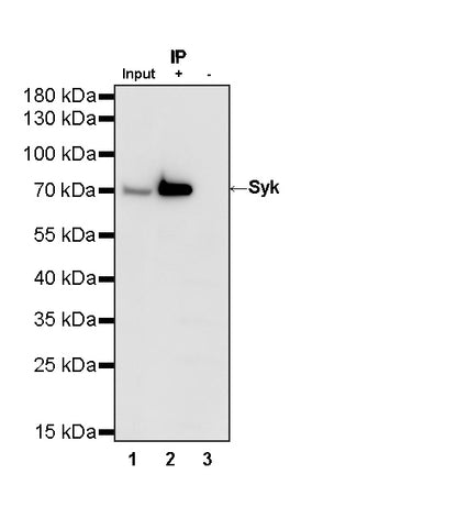Syk Recombinant Rabbit mAb (S-4400-11)