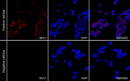 MUC1/EMA Mouse mAb (PE Conjugate) (S-777-37)