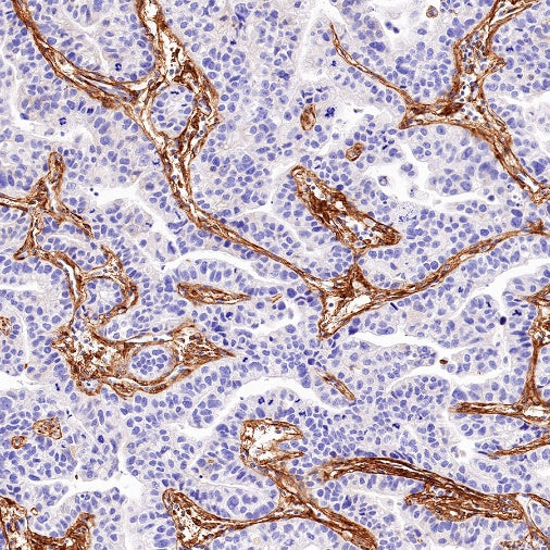 Collagen VI (COL6A1) Recombinant Rabbit mAb (S-1495-18)