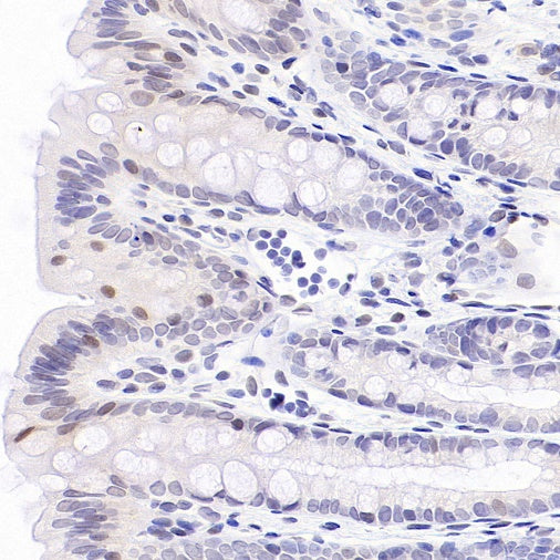 SMAD1 Rabbit Polyclonal antibody